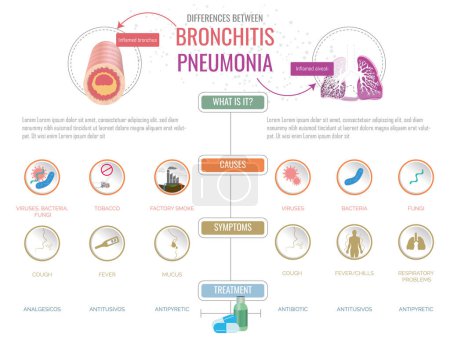 Illustration pour Différences entre bronchite et pneumonie, causes, symptômes et différents traitements, tous indiqués avec leurs icônes correspondantes. - image libre de droit