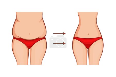 Ilustración de Concepto de pérdida de peso mujer aislado fondo blanco - Imagen libre de derechos