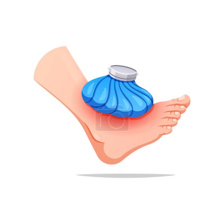 Illustration for First aid compress the foot. Foot with ice pack vector isolated on white background. - Royalty Free Image