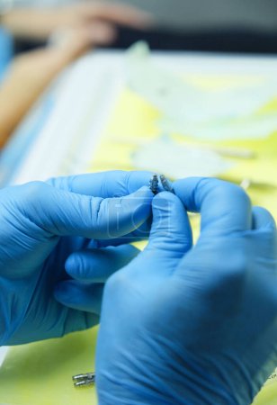 Foto de Primer plano, las manos del dentista con guantes azules se están preparando para la operación de implante en el consultorio del dentista. - Imagen libre de derechos