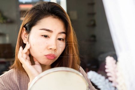 Photo for Asian Woman Checks Acne Scars on her face in a Mirror - Royalty Free Image