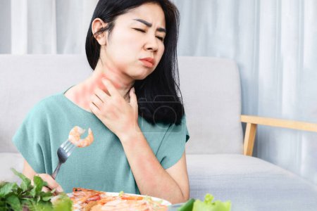 Photo for Asian woman have allergy reactions to shrimp or seafood have problems with rash, itching, and hives on the skin - Royalty Free Image