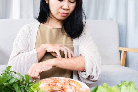 Téléchargez les photos : Femme asiatique ont des problèmes avec des démangeaisons cutanées éruptions cutanées et se gratter les bras causés par des allergies alimentaires après avoir mangé des crevettes - en image libre de droit