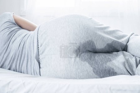 Photo for Closeup woman with wet pants because of Stress urinary incontinence can't control her pee while sleeping in bed - Royalty Free Image