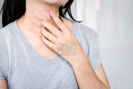 mujer rascándose la mano en el cuello, picazón en la piel