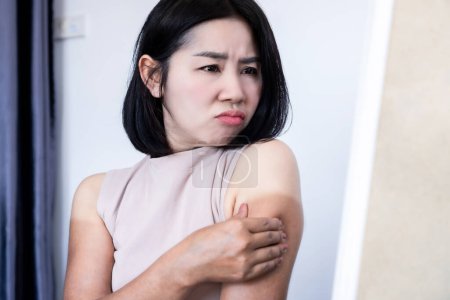 Photo for Asian woman have problem with uneven tan on arms checking on dark, sunburn and damaged skin in front of a mirror - Royalty Free Image