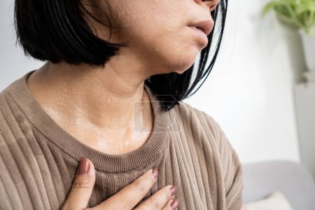Schwitzende Frau leidet an Hitzschlag und Hitzeerschöpfung während Hitzewelle im Sommer 