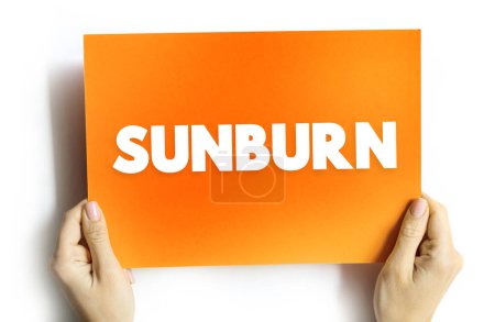 Téléchargez les photos : Les coups de soleil sont une forme de brûlure par rayonnement qui affecte les tissus vivants, tels que la peau, le concept de texte sur la carte - en image libre de droit