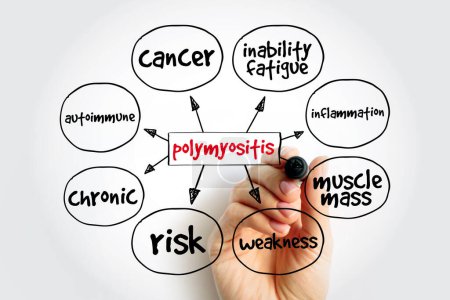 Photo for Polymyositis PM mind map, medical concept for presentations and reports - Royalty Free Image