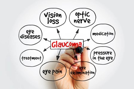 Foto de El glaucoma es un grupo de enfermedades oculares que resultan en daño al nervio óptico (o retina) y causan pérdida de visión, mapa mental antecedentes concepto médico - Imagen libre de derechos