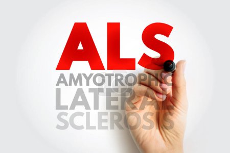ALS Amyotrophic Lateral Sclerosis - progressive nervous system disease that affects nerve cells in the brain and spinal cord, acronym text concept background