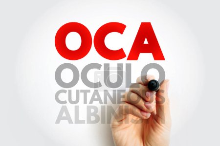 OCA Oculocutaneous Albinism - genetic disorder characterized by skin, hair, and eye hypopigmentation due to a reduction or absence of melanin, acronym text concept background