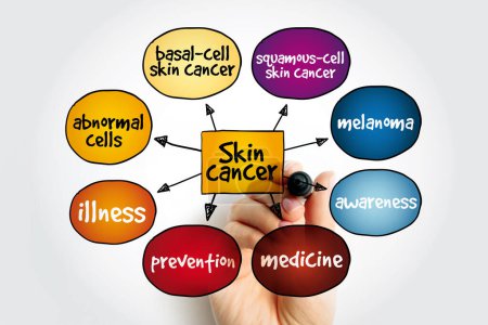 Hautkrebs-Mindmap, medizinisches Konzept für Präsentationen und Berichte
