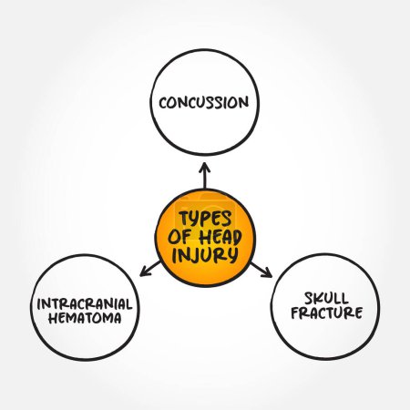 Ilustración de Different types of head injury, mind map text concept for presentations and reports - Imagen libre de derechos