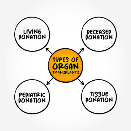 Illustration for Types of Organ Transplants (medical procedure in which an organ is removed from one body and placed in the body of a recipient), mind map text concept background - Royalty Free Image