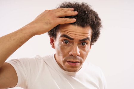 Téléchargez les photos : Handsome mixed race adult man is worried because of hair loss. - en image libre de droit