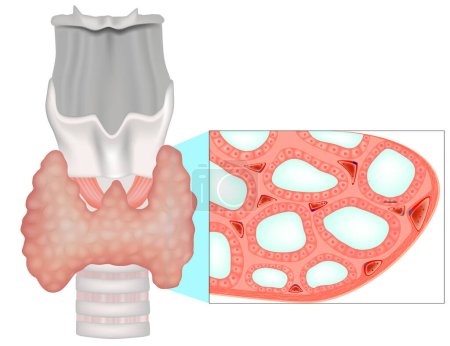 Ilustración de Estructura de la glándula tiroides. Estructura histológica del folículo tiroideo o de las células epiteliales o de los tirocitos - Imagen libre de derechos