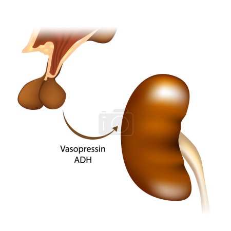 vasopresina