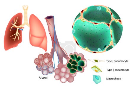 Ilustración de Ilustración médica de las células neumocitarias Tipo 1 y 1, Macrophage. Produjo Mucins. Tejido pulmonar y alveolo pulmonar. Pulmones del sistema respiratorio - Imagen libre de derechos