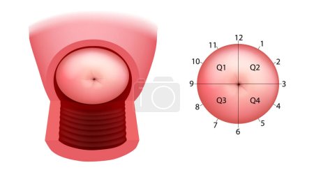 Gebärmutterhalskrebs Quadranten und Richtungen. Die anatomische Position des Gebärmutterhalses. Kolposkopie. Gebärmutterhalsanatomie.