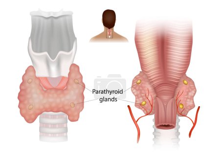 Glándulas paratiroideas. Diagrama que muestra estructuras en el cuello humano. Glándulas paratiroides superiores e inferiores
