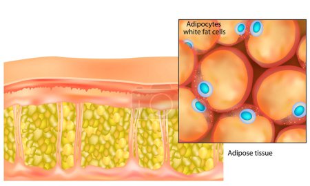 Adipose tissue. Adipocytes white fat cells. Lipocytes and fat cells