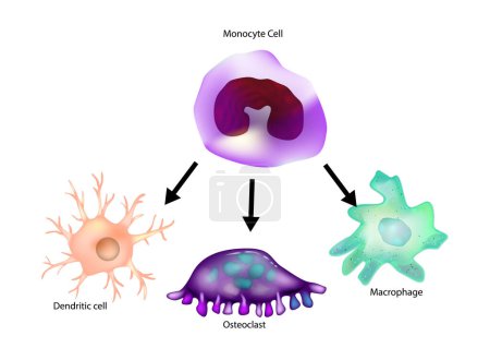 Différenciation des monocytes. Macrophage, cellules dendritiques, ostéoclaste. Type de leucocytes ou de globules blancs