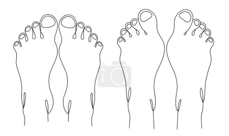 Illustration for Human legs. View from above. Normal foot and valgus foot deformity. World Clubfoot Day. One line drawing for different uses. Vector illustration. - Royalty Free Image