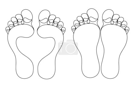 Ilustración de Pie humano normal y pies planos. Deformidad del pie. Huella humana. Día Mundial del pie zambo. Dibujo de una línea para diferentes usos. Ilustración vectorial. - Imagen libre de derechos