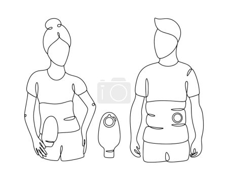 Illustration for Patients with an ostomy band. Ostomy patient. Ostomy Awareness Day. One line drawing for different uses. Vector illustration. - Royalty Free Image