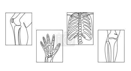 Illustration for X-ray image of the knee joint, hand, chest and knee. International Day of Radiology. One line drawing for different uses. Vector illustration. - Royalty Free Image