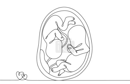 Illustration for Monozygotic twins in the womb. Children with one placenta. Identical twins. Twins Days. One line drawing for different uses. Vector illustration. - Royalty Free Image