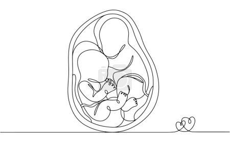 Illustration for Dizygotic twins in the womb. Children with different placentas. Fraternal lickers. Twins Days. One line drawing for different uses. Vector illustration. - Royalty Free Image