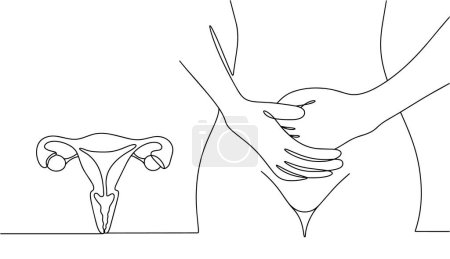 Illustration for The woman is holding her lower abdomen. Severe female pain. Problems with the female reproductive system. Vector illustration. Images produced without the use of any form of AI software at any stage. - Royalty Free Image
