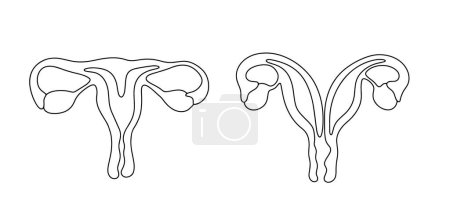 Uterus mit Septum und bicornuatem Uterus. Abnorme Struktur des weiblichen Organs. Medizinische Illustration. Vektorillustration. Bilder, die in jeder Phase ohne den Einsatz von KI-Software erstellt werden. 