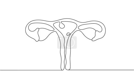 Endometrial polyps inside the uterus. Disease of the female reproductive system. Benign formation inside the uterine cavity. Images produced without the use of any form of AI software at any stage. 