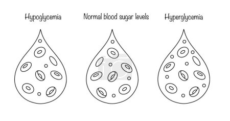 Glukosespiegel im menschlichen Blut. Glukosemangel, normal und überschüssig. Medizinische Illustration mit Linie. Vektor.
