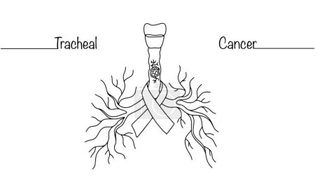 Human tracheal cancer. Trachea and bronchi of a person with signs of oncology. Anti-cancer tape around the trachea. A symbol of the need for timely diagnosis and treatment of cancer. Simple vector.
