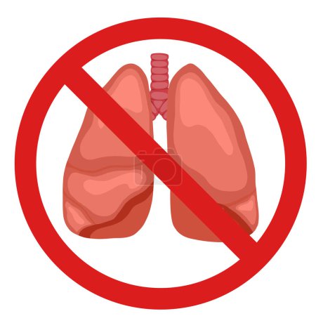 Illustration for Anatomical vector illustration of human lungs in forbidden sign isolated from background. Transplant ban. Cartoon human body organ. Vector prohibited element for articles, banners and educational card - Royalty Free Image