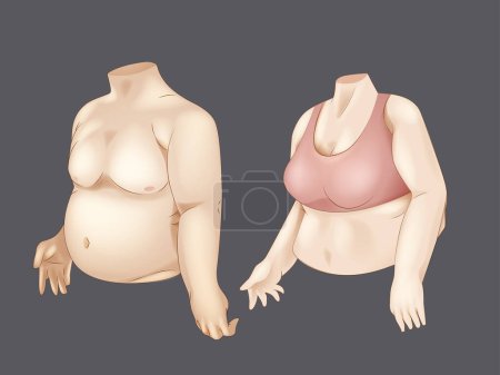Ilustración de Concepto graso hombre y mujer cuerpo malsano sobrepeso forma ilustración vector realista - Imagen libre de derechos