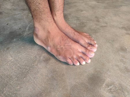 Jeune homme pieds nus, ongles masculins, ongles humains du village indien, cheveux, peau, pied,