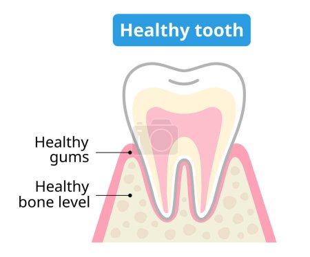 Ilustración de Dientes y encías saludables. prevención de la gingivitis y periodontitis. Concepto de higiene dental y bucal - Imagen libre de derechos