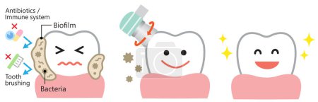 dental biofilm removal cute character illustration. dental health and oral care concept