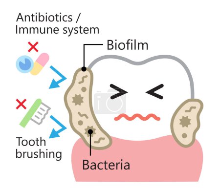 biofilm dental lindo personaje ilustración. bacterias y placa de fijación en el diente. salud dental y concepto de cuidado bucal