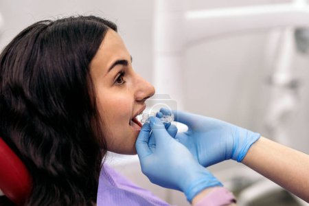 Téléchargez les photos : Stock photo of woman sitting in dentist's chair putting on teeth covers. - en image libre de droit