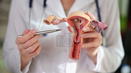 Woman gynecologist demonstrating model of female reproductive system in medical clinic. Gynecological care and healthy female reproductive system concept.