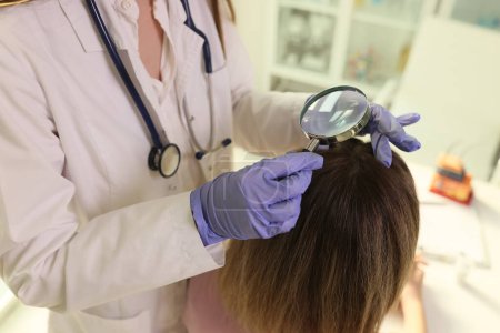 Trichologist finds out cause of hair loss of female patient. Specialist in coat and rubber gloves looks at scalp through magnifier glass