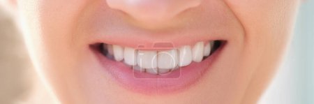 Gros plan de la femme souriante heureuse avec des dents blanches parfaites. Blanchiment des dents, soins dentaires et stomatologie concept
