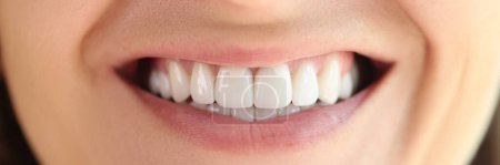 Photo for Beautiful smile with great healthy smooth white teeth close up. Dental health concept. - Royalty Free Image