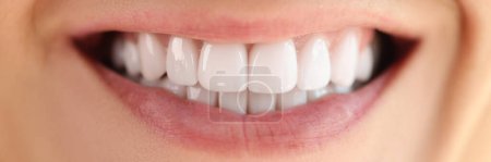 Téléchargez les photos : Close-up of healthy smooth white teeth smile. Concept of dentistry and dental health care. - en image libre de droit